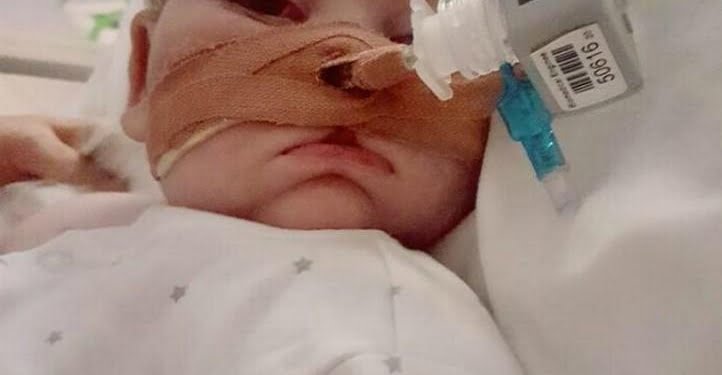 Charlie-Gard-eyes-fb