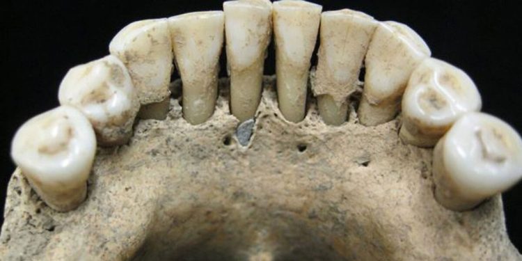 Dentatura di epoca medievale