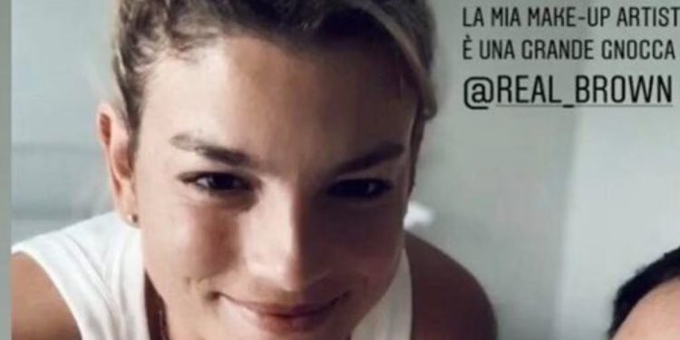 Emma Marrone, foto dopo operazione