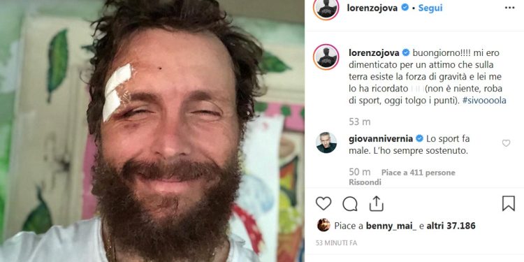 Jovanotti incerottato su Instagram