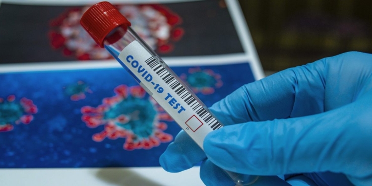 Covid, Canada avverte contro nuovo virus