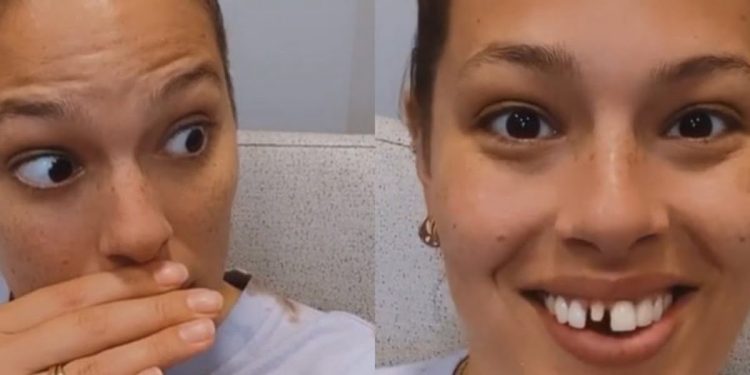 Ashley Graham si rompe un dente