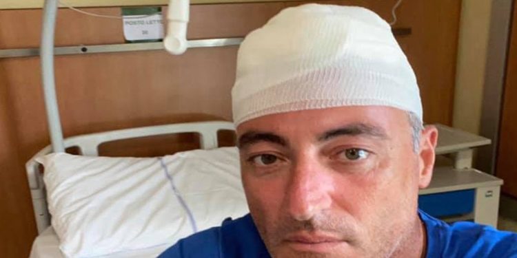 Giulio Gallera, incidente giocando a paddle (Foto: Facebook)