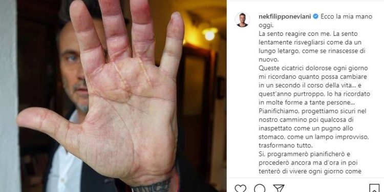 Nek e la foto della mano (Instagram)