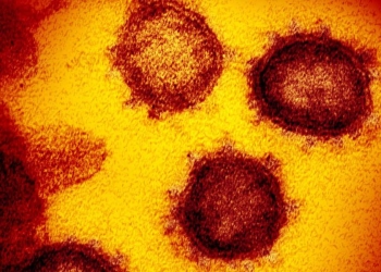 Coronavirus al microscopio (LaPresse)