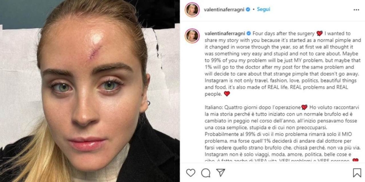 Valentina Ferragni, Instagram