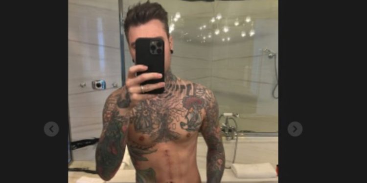 Fedez dimagrito posta la foto su Instagram