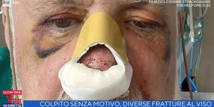 Enrico Borla, medico colpito con pugno in faccia senza motivo