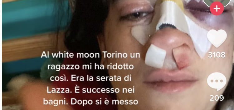 Su Tik Tok ragazza picchiata in discoteca a Torino