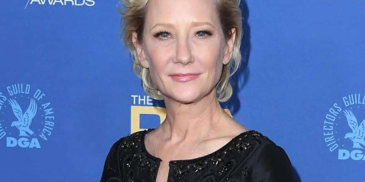 Anne Heche (Foto: web)