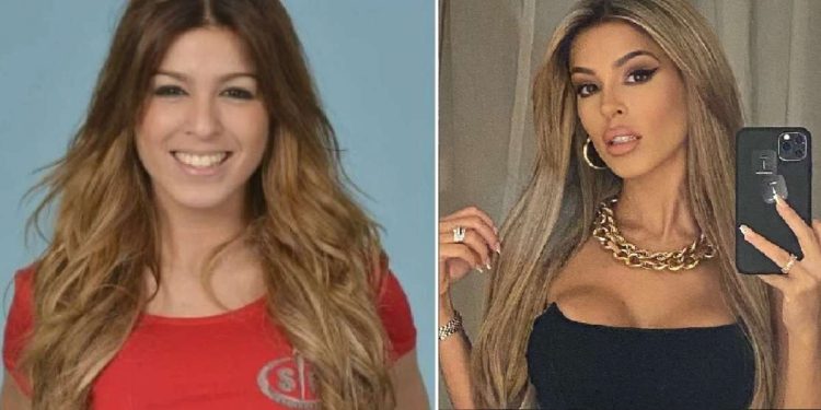 Oriana Marzoli prima e dopo