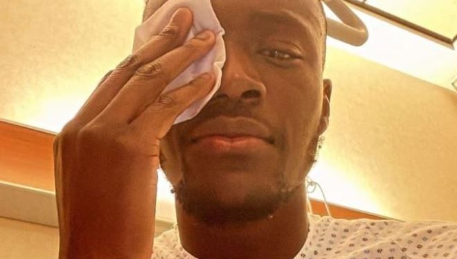 Tammy Abraham mostra l'occhio ferito su Instagram