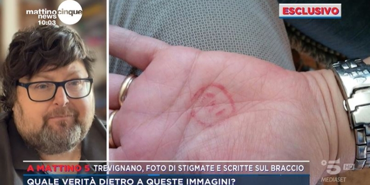 Mattino 5 mostra la mano con le stigmate della veggente della Madonna di Trevignano