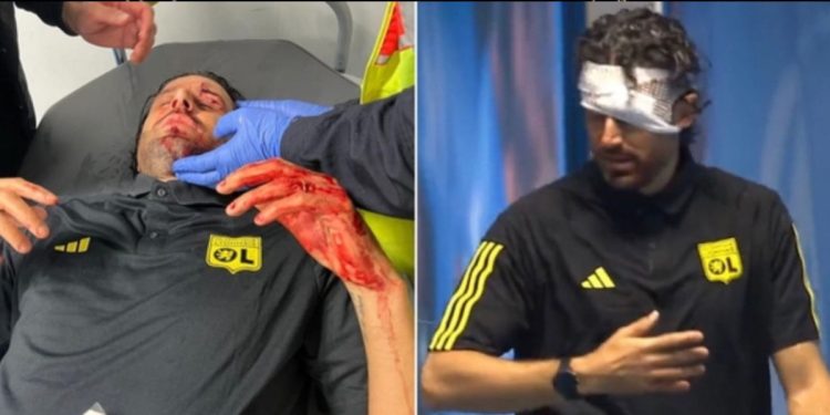 Fabio Grosso ferito sul pullman del Lione preso a sassate