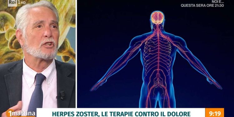 Il punto sull'Herpes Zoster a Uno Mattina