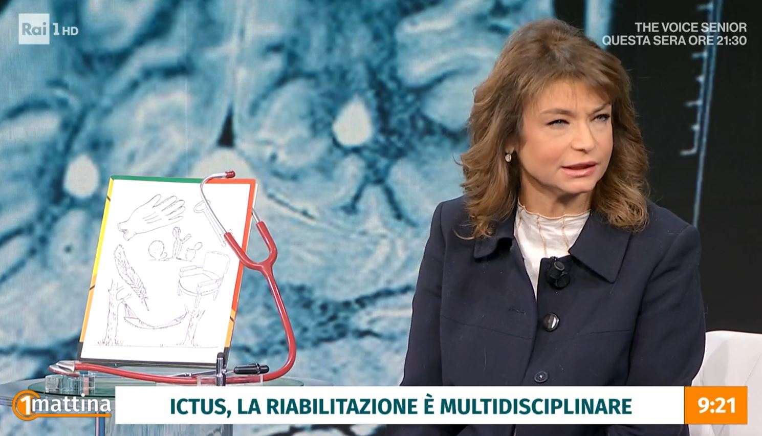 Ictus, 25% pazienti ha meno di 65 anni”/ Prof Anticoli: “Ogni 2 minuti di  danno cervello invecchia”