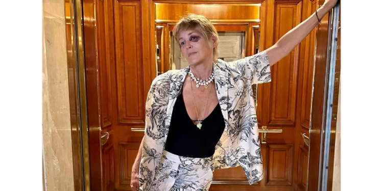 Sharon Stone con occhio nero