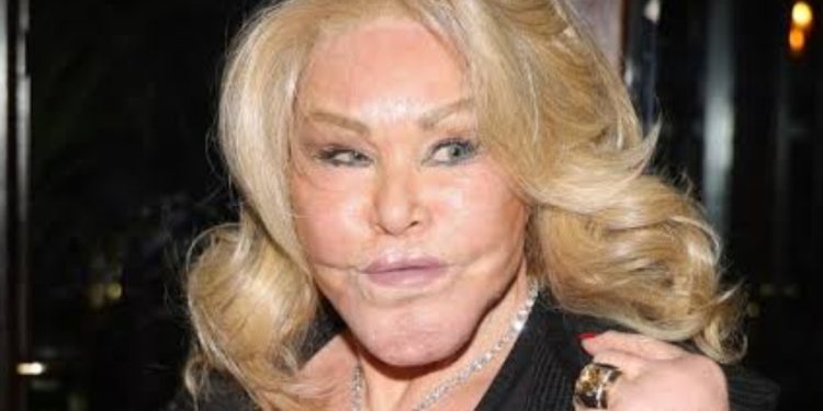 Jocelyn Wildenstein